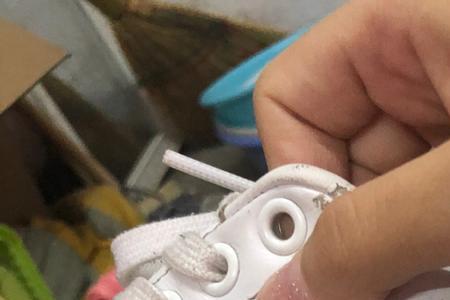 鞋边为什么越刷越黄