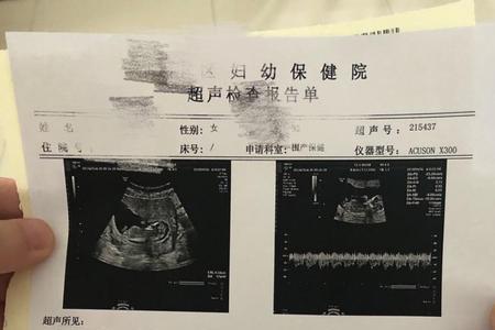 女生发nt什么意思