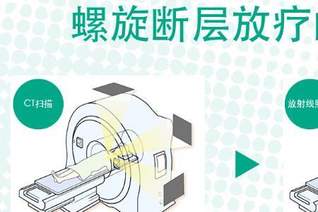伽玛刀报销标准