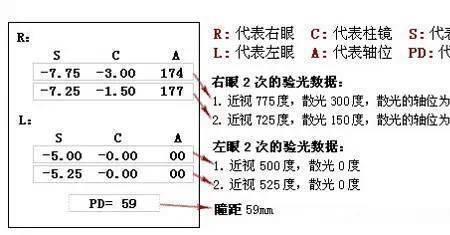 散光150轴距多少