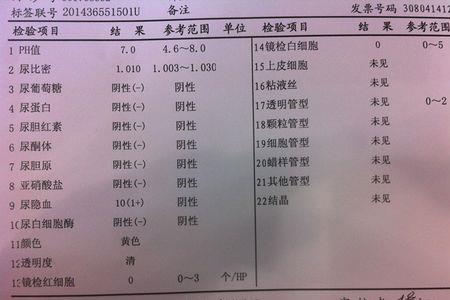 进厂体检为什么要尿检