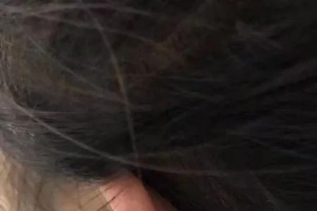 耳洞长上后怎么通开