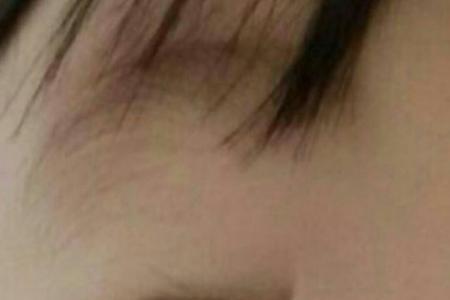 眼睛的最中间的小圆点是什么