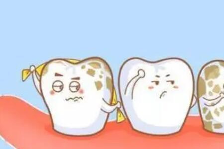 虎斑牙是怎么形成的