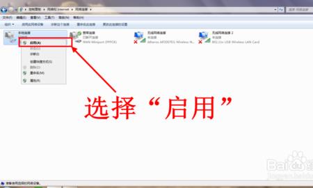 内网本地连接用不了