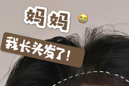 为什么头发两边发量不均匀