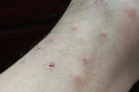 网络上的跳蚤是什么意思