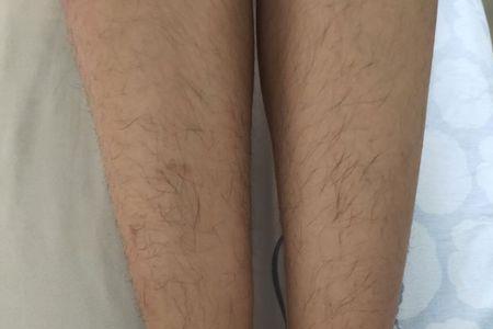 女生为什么没有腿毛
