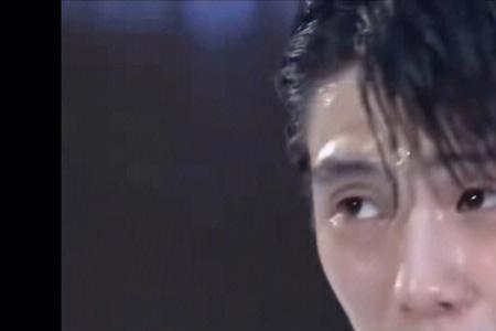 羽生结弦什么时候整牙