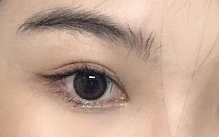 卧蚕是下双眼皮吗