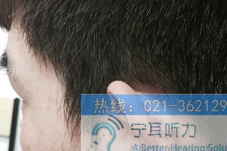 助听器反馈是什么意思