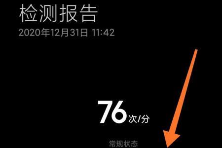 小米手机测心率那些手机支持