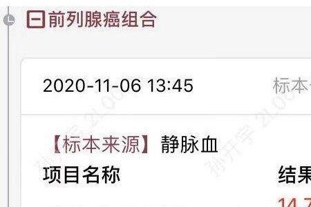 qa检查是什么