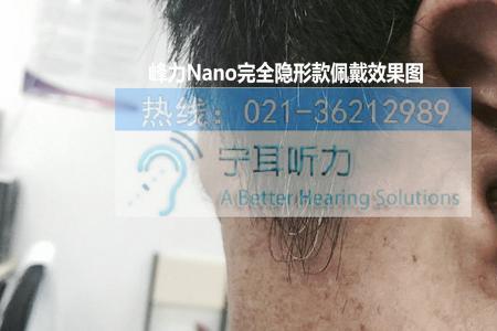 海尔助听器使用效果好吗