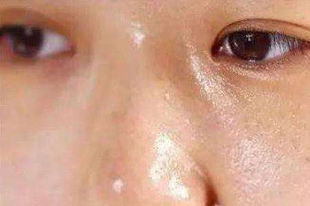 为什么洗脸之后五官变立体了