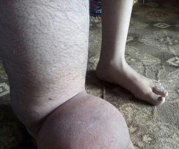 象腿一般多长