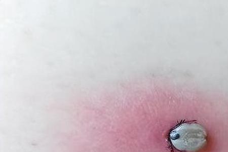 吸血虫蜱虫在家是怎样产生的