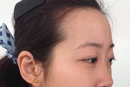 为什么女生脑门都那么大