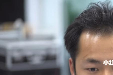 头发中间发际线叫什么