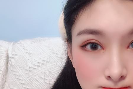双眼皮一般有多厚