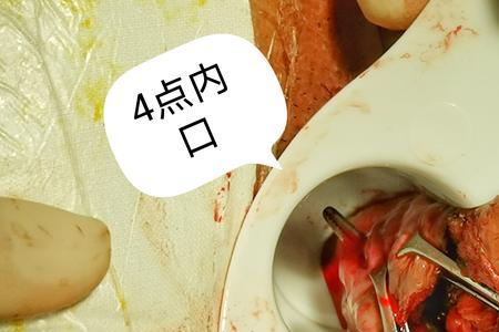 pph是谁的缩写