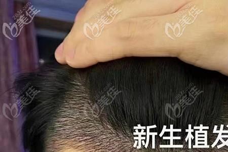 人的头发是每天都在新生吗