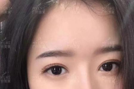 直播时经常眨眼睛怎么办