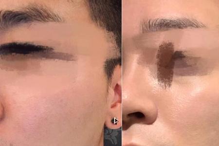 男士面部变帅最快方法