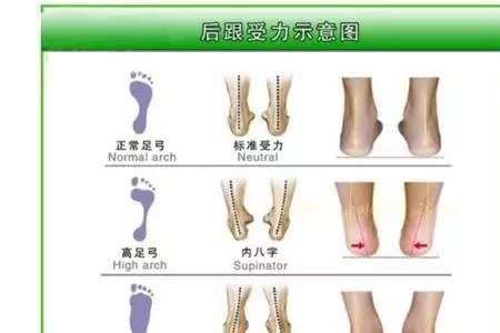 内八字女生性格
