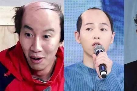 流浪汉为什么不秃头