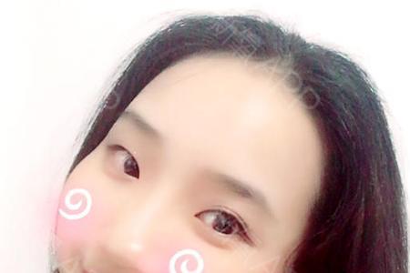 他说我笑起来酒窝好看