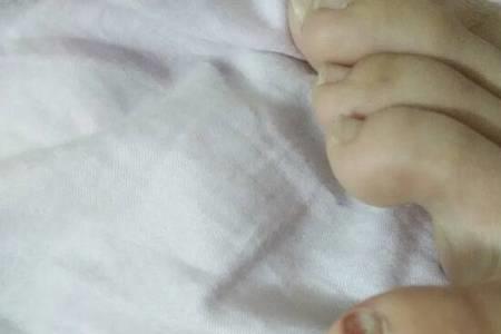 女生说撞到脚了该怎么回