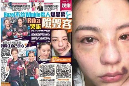 签了生死状打死犯法吗