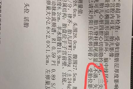 谁知道L5是什么意思