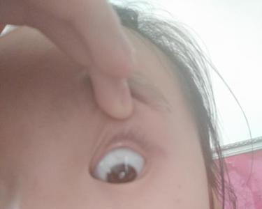 伊对里的黄点是什么意思