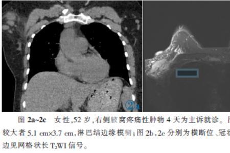 adc医学影像学是什么意思
