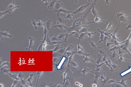 伪足是什么意思