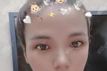 为什么马都是双眼皮啊