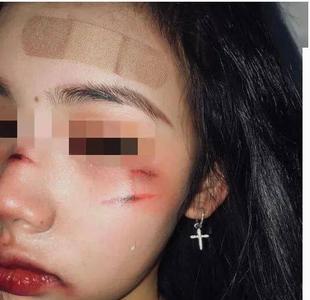女人对付家暴的十大方法