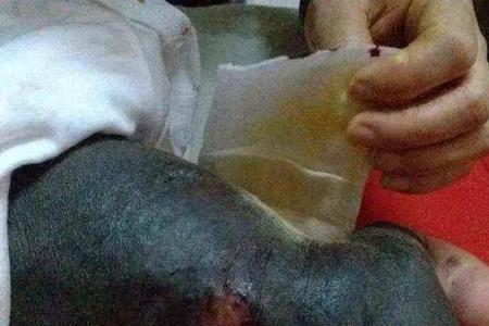 烧焦的人是什么样的