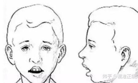 人将死为何要张嘴呼吸