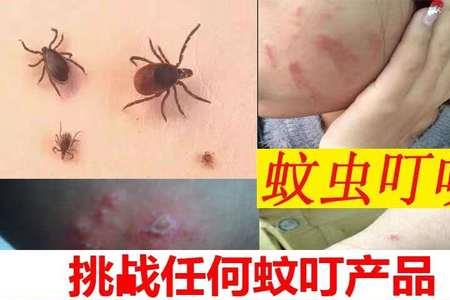 热开水会烫死跳蚤吗