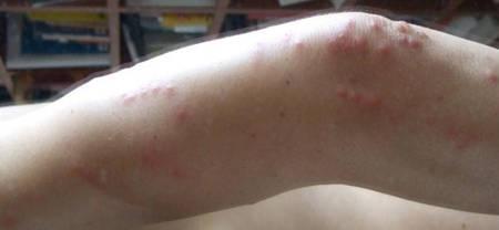 臭虫和小蟑螂区别图片
