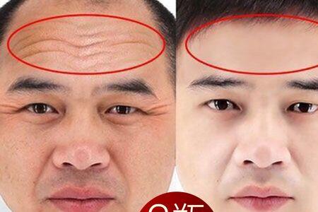 男人抬头纹什么时候有