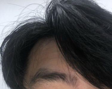 眼镜突然裂开怎么办
