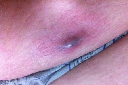 男生的肚子如何长得像女生的