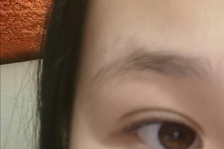怎么反驳说你是斗鸡眼的人