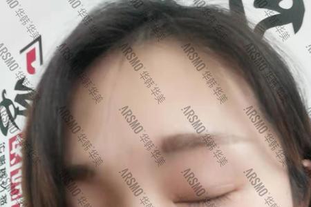 什么人总爱闭一只眼