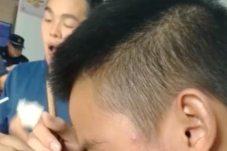 为什么有人一直闭着一只眼