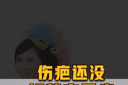 歌曲好了伤疤忘了疼原唱
